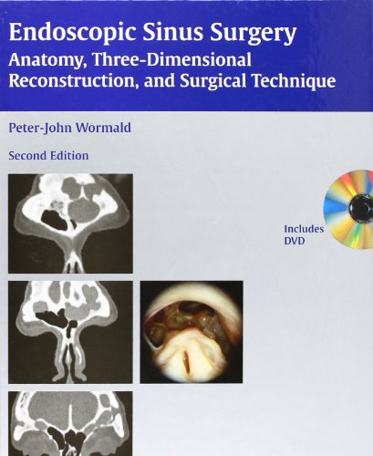 9783131394224: Endoscopic Sinus Surgery: Anatomy, Three-dimensional Reconstruction, and Surgical Technique