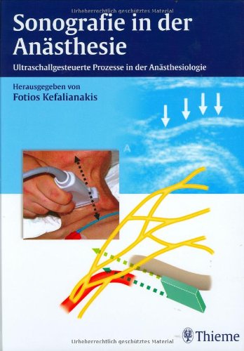 Beispielbild fr Sonographie in der Ansthesie. Ultraschallgesteuerte Prozesse in der Ansthesiologie (Gebundene Ausgabe) von Fotios Kefalianakis zum Verkauf von BUCHSERVICE / ANTIQUARIAT Lars Lutzer