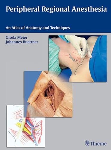 Atlas of Regional Anesthesia Techniques: An Atlas of Anatomy and Techniques (9783131397911) by Gisela Meier