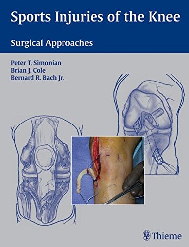 9783131402912: Sports Injuries of the Knee: Surgical Approaches