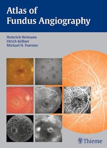 Imagen de archivo de Atlas of Fundus Angiography a la venta por Revaluation Books