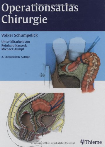 Beispielbild fr Operationsatlas Chirurgie Schumpelick, Volker; Kasperk, Reinhard and Stumpf, Michael zum Verkauf von BUCHSERVICE / ANTIQUARIAT Lars Lutzer