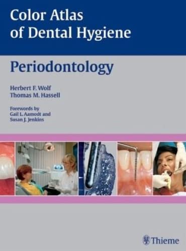 Stock image for Color Atlas of Dental Hygiene: Periodontology for sale by GF Books, Inc.