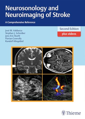 Stock image for Neurosonology and Neuroimaging of Stroke - 2E for sale by Books Puddle