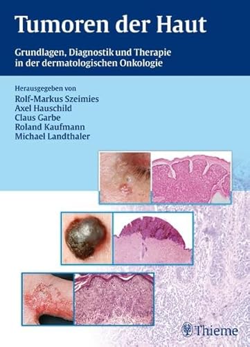 Stock image for Tumoren der Haut: Grundlagen, Diagnostik und Therapie in der dermatologischen Onkologie [Gebundene Ausgabe] Onkologie Apoptose Aufklrungsgesprch Dermatologie Dermatologie Allergologie Dermatoonkologie Epitheliale Hauttumoren Evidenzbasierte Leitlinien Genetik Mediziner Klinische Fcher Hauterkrankungen Hautkrebs Hauttumoren Medizinisch Klinisches Fach Hereditre Tumorsyndrome HEREDITRE TUMORSYN DROME Klassifikation Klinische Studien Krebs (Med.) Kryochirurgie Kutane Lymphome Lasertherapie Lebensqualitt Maligne Progression Malignes Melanom Metastasierung Onkogenese Patientenaufklrung Rolf-M. Szeimies (Autor), Axel Hauschild (Autor), Claus Garbe (Autor) Roland Kaufmann (Herausgeber), Michael Landthaler (Herausgeber), Jann Arends (Mitwirkende), Chalid Assaf (Mitwirkende), Matthias Augustin (Mitwirkende), Stefan Bartsch (Mitwirkende), Jrgen Bauer (Mitwirkende), Jrgen C. Becker (Mitwirkende), Mark Berneburg (Mitwirkende), Beate Bestmann (Mitwirkende), Marc Beyer (Mitwirkende), Michae for sale by BUCHSERVICE / ANTIQUARIAT Lars Lutzer