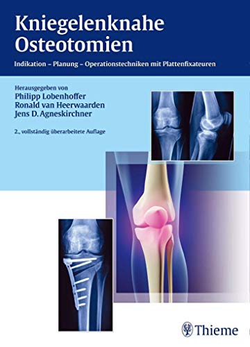 9783131428929: Kniegelenknahe Osteotomien: Indikation - Planung - Operationstechniken mit Plattenfixateuren