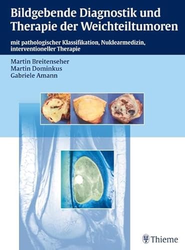 9783131431318: Bildgebende Diagnostik und Therapie der Weichteiltumoren: mit pathologischer Klassifikation, Nuklearmedizin, interventioneller Therapie