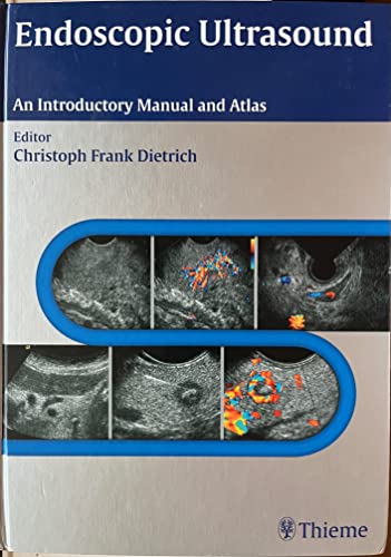 9783131431516: Endoscopic Ultrasound: An Introductory Manual and Atlas