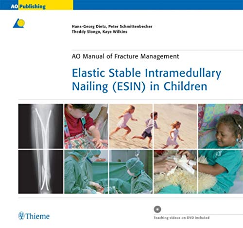 Beispielbild fr Elastic Stable Intramedullary Nailing (ESIN) in Children AO-Publishing Unfallchirurgie Orthopdie Association for the Study of Internal Fixation ESIN Elastic Stable Intramedularry Nailing Frakturbehandlung Medizin Klinische Fcher Kind Kinderheilkunde Pdiatrie Orthopdie Minimalinvasive Therapie Nagelung Orthopdie Orthopde Allgemeinmedizin Pdiater Hans-Georg Dietz, Peter P Schmittenbecher, Theddy Slongo, Kaye E. Wilkins (Autoren) zum Verkauf von BUCHSERVICE / ANTIQUARIAT Lars Lutzer