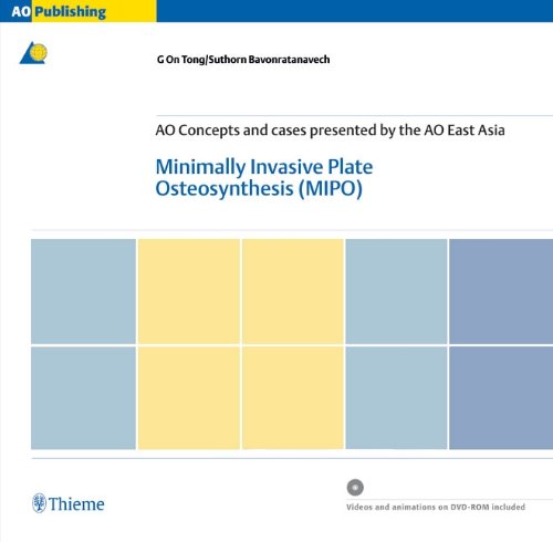 Beispielbild fr Minimally Invasive Plate Ostheosynthesis (MIPO): Concepts and cases presented by the AO East Asia (AO-Publishing) zum Verkauf von dsmbooks