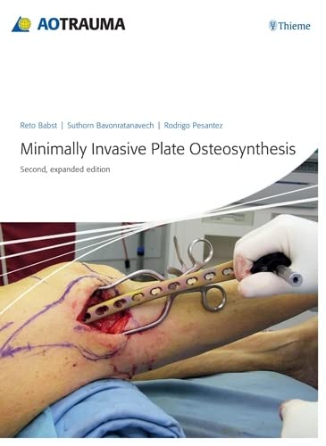 9783131433923: Minimally Invasive Plate Osteosynthesis (MIPO)