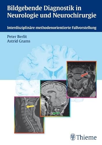 9783131436610: Bildgebende Diagnostik in der Neurologie und Neurochirurgie: Interdisziplinre methodenorientierte Fallvorstellung