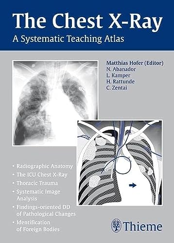 Stock image for The Chest X-Ray: A Systematic Teaching Atlas Hofer, Matthias for sale by Brook Bookstore