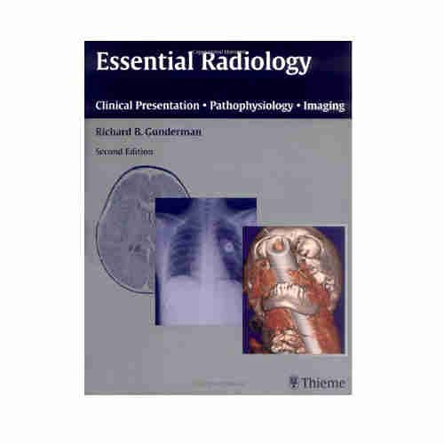 Stock image for ESSENTIAL RADIOLOGY : CLINICAL PRESENTATION , PATHOPHYSIOLOGY , IMAGING (2/E) (PB) for sale by Basi6 International