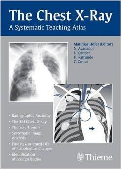 9783131449719: The Chest X-Ray A Systematic Teaching Atlas [Paperback] [Jan 01, 2012] Hofer Abanador Kamper Rattunde Zentai