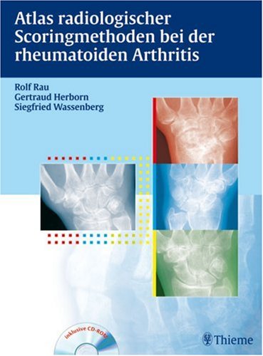 9783131458810: Atlas radiologischer Scoringmethoden bei der rheumatoiden Arthritis