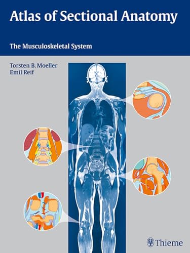 Stock image for Atlas of Sectional Anatomy: The Musculoskeletal System for sale by GoldenWavesOfBooks