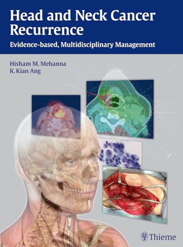 Stock image for HEAD AND NECK CANCER RECURRENCE: EVIDENCE-BASED, MULTIDISCIPLINARY MANAGEMENT 1/E (EXCL. ABC) for sale by Romtrade Corp.