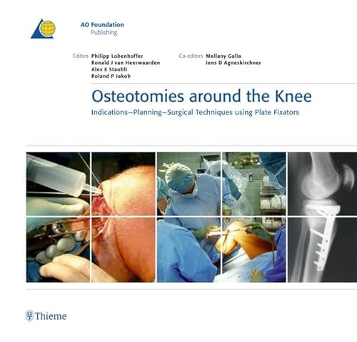 Beispielbild fr Osteotomies Around the Knee: Indications - Planning - Surgical techniques using Plate Fixators (AO-Publishing) zum Verkauf von Mispah books