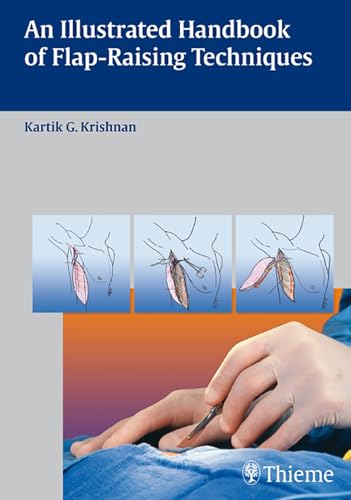 9783131477613: An Illustrated Handbook of Flap-Raising Techniques