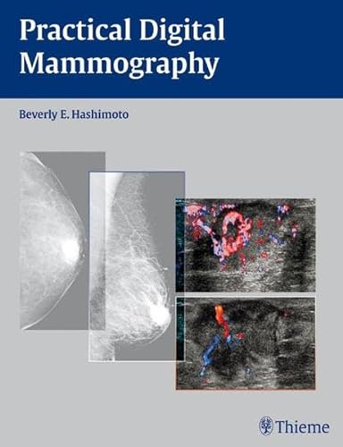 Beispielbild fr Practical Digital Mammography zum Verkauf von CSG Onlinebuch GMBH