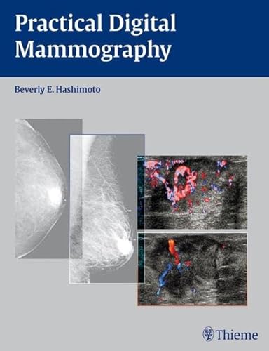 Stock image for Practical Digital Mammography for sale by CSG Onlinebuch GMBH