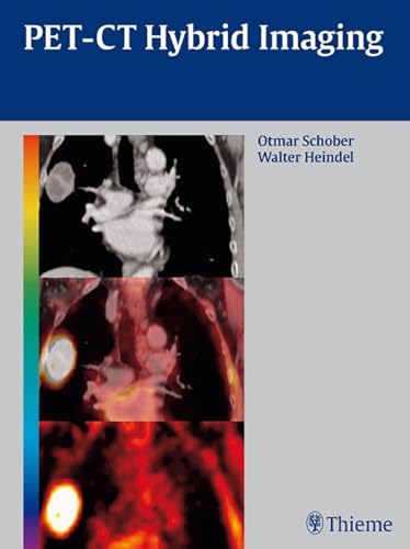 PET-CT Hybrid Imaging (9783131488619) by Schober, Otmar; Heindel, Walter