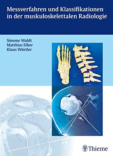 9783131497215: Messverfahren und Klassifikationen in der muskuloskelettalen Radiologie