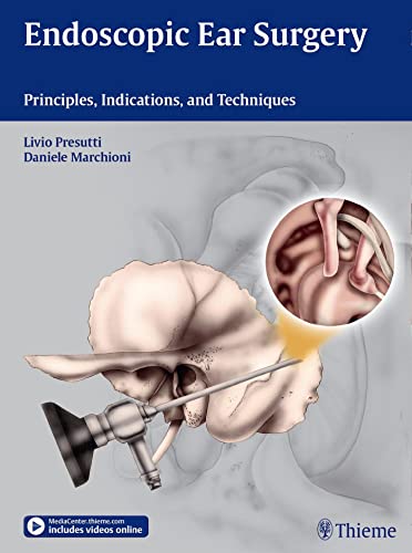 9783131630414: Endoscopic Ear Surgery: Principles, Indications, and Techniques