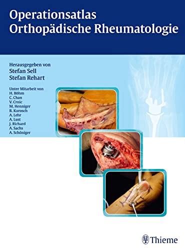 Operationsatlas. Orthopädische Rheumatologie