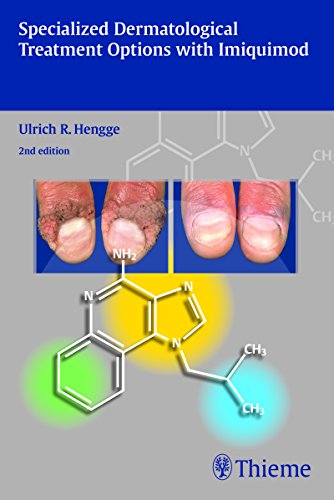 9783131706928: Specialized Dermatological Treatment Options with Imiquimod