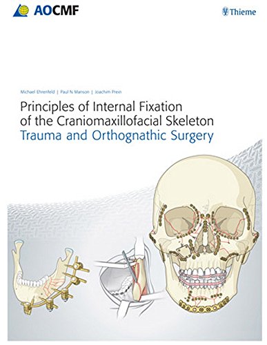 9783131714817: Principles of Internal Fixation of the Craniomaxillofacial Skeleton: Trauma and Orthognathic Surgery