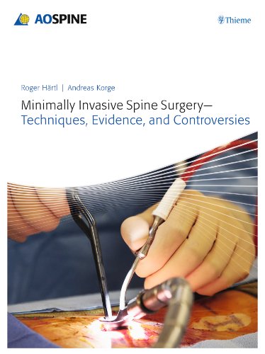 Beispielbild fr Minimally Invasive Spine Surgery - Techniques, Evidence, and Controversies zum Verkauf von Front Cover Books
