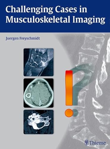 Stock image for Challenging Cases in Musculoskeletal Imaging for sale by ThriftBooks-Atlanta