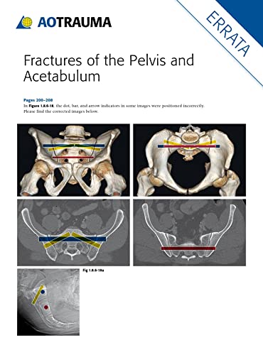 9783132006317: Fractures of the Pelvis and Acetabulum: Principles and Methods of Management