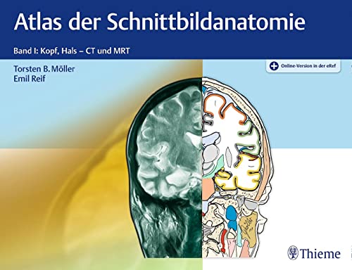 Imagen de archivo de Atlas der Schnittbildanatomie: Band I: Kopf, Hals a la venta por medimops