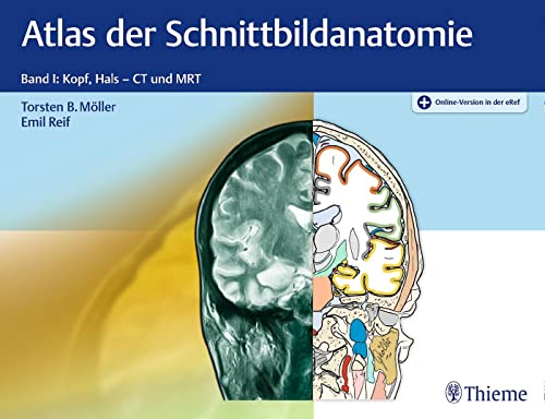 Stock image for Atlas der Schnittbildanatomie: Band I: Kopf, Hals for sale by medimops