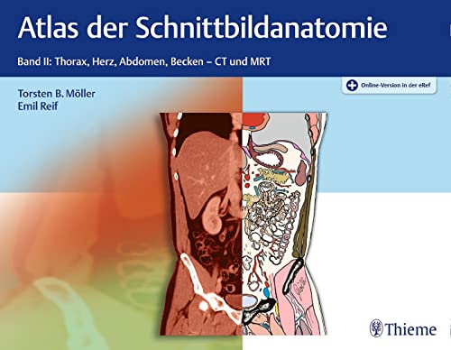 Stock image for Atlas der Schnittbildanatomie: Band II: Thorax, Herz, Abdomen, Becken for sale by medimops