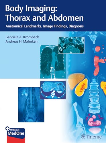9783132054110: Body Imaging: Thorax and Abdomen: Anatomical Landmarks, Image Findings, Diagnosis