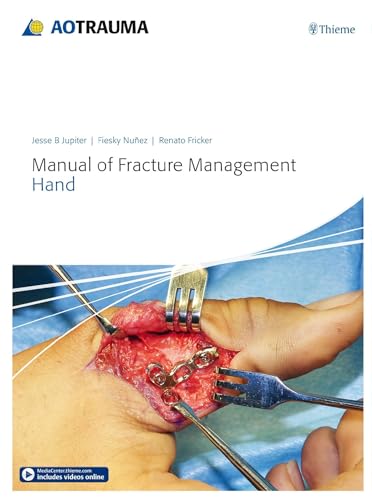 9783132215818: Manual of Fracture Management - Hand