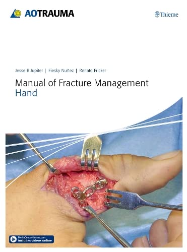 Stock image for Manual of Fracture Management - Hand for sale by BookstoYou