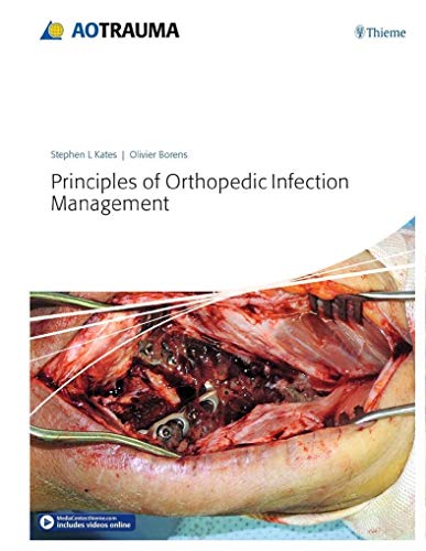 9783132410756: Principles of Orthopedic Infection Management