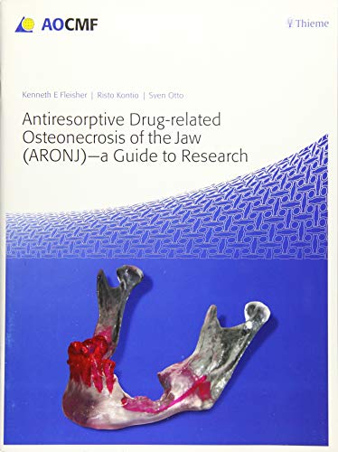 Beispielbild fr Antiresorptive Drug-Related Osteonecrosis of the Jaw (ARONJ) - A Guide to Research zum Verkauf von Blackwell's