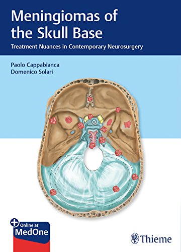 Stock image for Meningiomas of the Skull Base : Treatment Nuances in Contemporary Neurosurgery for sale by Better World Books Ltd