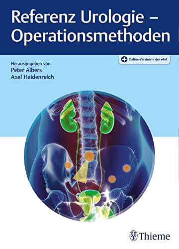 Imagen de archivo de Referenz Urologie - Operationsmethoden a la venta por medimops