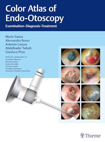 Stock image for Color Atlas of Endo-Otoscopy for sale by Blackwell's