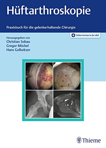 Stock image for Hftarthroskopie: Praxisbuch fr die gelenkerhaltende Chirurgie for sale by Revaluation Books