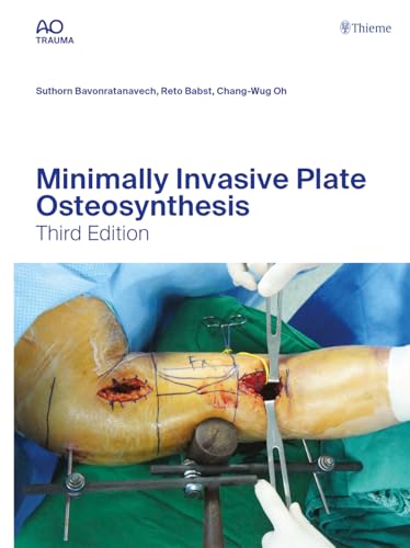 Beispielbild fr Minimally Invasive Plate Osteosynthesis zum Verkauf von medimops