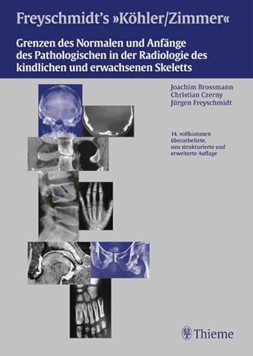 9783133622141: Grenzen des Normalen und Anfnge des Pathologischen in der Radiologie des kindlichen und erwachsenen Skeletts