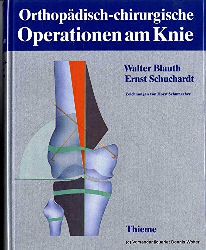 Beispielbild fr Orthopdisch-chirurgische Operationen am Knie [Gebundene Ausgabe] Walter Blauth Ernst Schuchardt Kniegelenkkrankheit Chirurgie Atlas Medizin Gesundheit Anthroposkopie Kniegelenkkrankheit Chirurgie Atlas knee Orthopdisch-chirurgischer Operationsatlas ; Bd. 6 zum Verkauf von BUCHSERVICE / ANTIQUARIAT Lars Lutzer